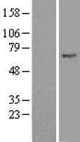 FBXW11 Protein (Over-Expression Lysate Myc-DDK (Flag))