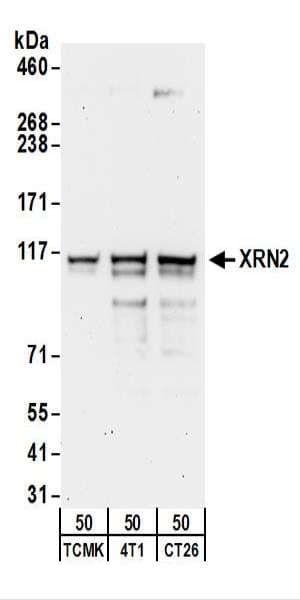 IHC-plus™ XRN2 Antibody (aa900-950)