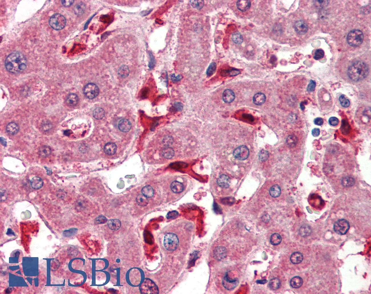 IHC-plus™ GPX1 / Glutathione Peroxidase Antibody (aa130-142)