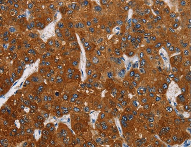 Polyclonal Rabbit anti-Human CARD9 Antibody (IHC)