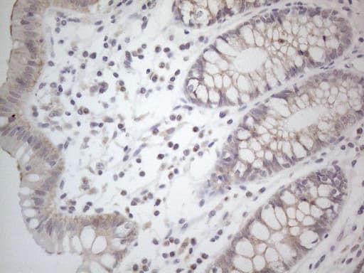 NPPB / BNP Antibody (aa27-102, clone OTI11G4)