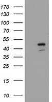 SERPINB4 / SCCA1+2 Antibody (clone OTI1G6)