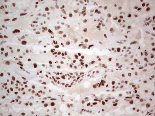 Monoclonal Mouse anti-Human RB1 / Retinoblastoma / RB Antibody (clone OTI3F11, aa309-590, IHC, WB)