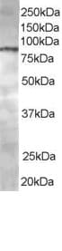 IHC-plus™ CENTB1 / ACAP1 Antibody (aa728-740)