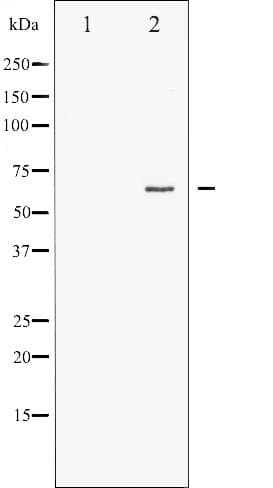 Polyclonal Rabbit anti-Human ER Alpha / Estrogen Receptor Antibody (phospho-Ser167, IHC, IF, WB)