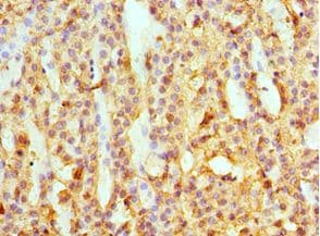 SULT2A1 / Sulfotransferase 2A1 Antibody (aa1-145)