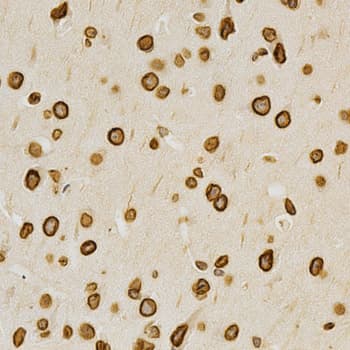 LMNA / Lamin A+C Antibody