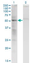 SS18 Antibody (clone 1C8)