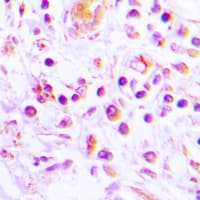 Polyclonal Rabbit anti-Human IL32 Antibody (C-Terminus, IHC, WB)