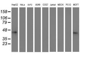 ALS2CR1 / NIF3L1 Antibody (clone OTI1F6)