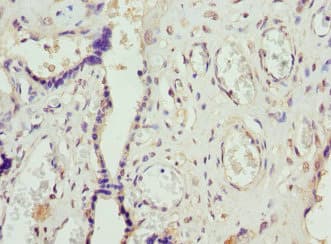FCGRT / FCRN Antibody