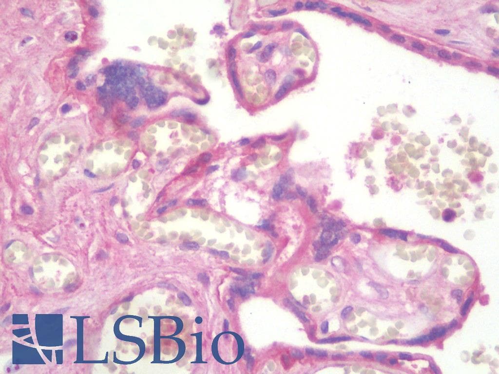 IHC-plus™ ITGB4 / Integrin Beta 4 Antibody (aa1619-1822, clone 10B10D5)