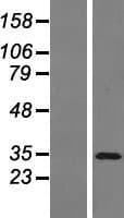 ZMAT3 Protein (Over-Expression Lysate Myc-DDK (Flag))