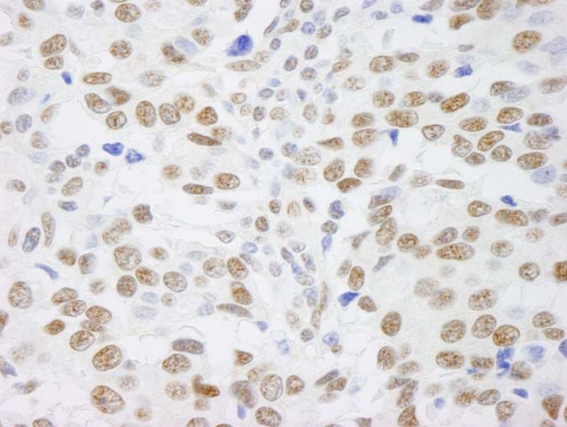 SAFB1 / SAFB Antibody (aa875-C-term)