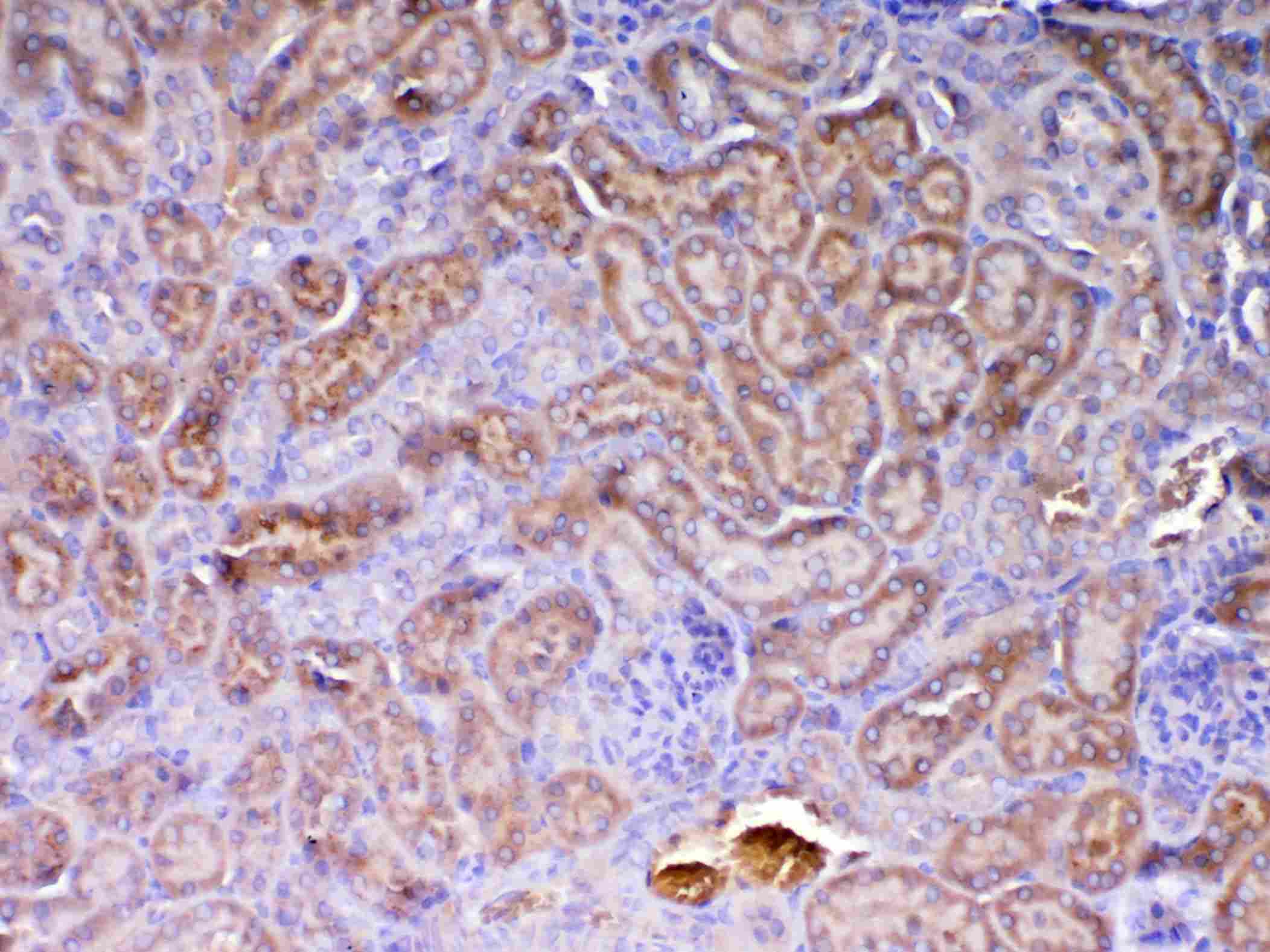AMD / AMD1 Antibody