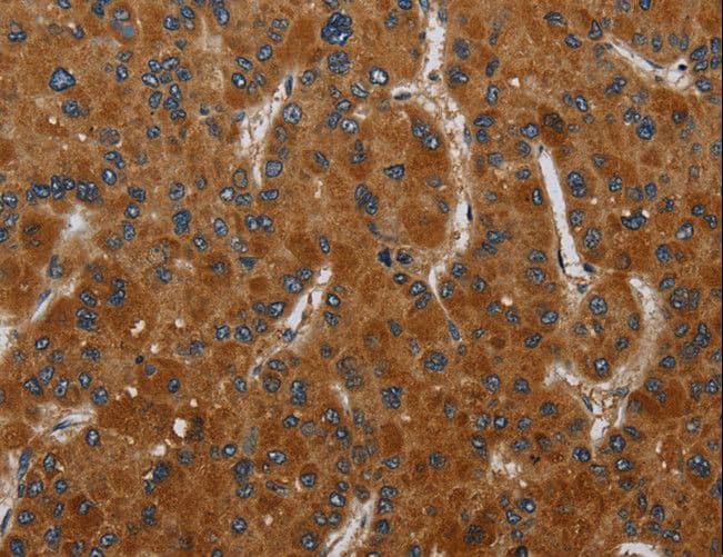 CSH1 / Placental Lactogen Antibody