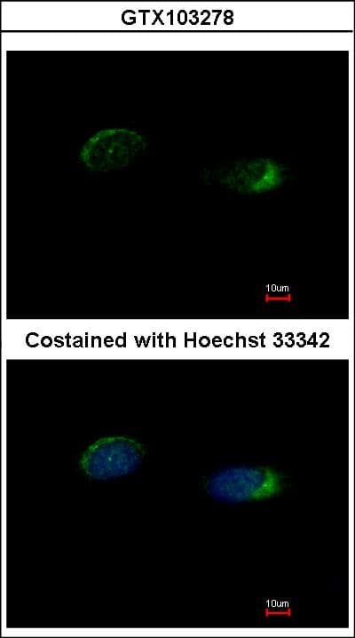 IHC-plus™ HOMER1 / Homer 1 Antibody (aa72-339)