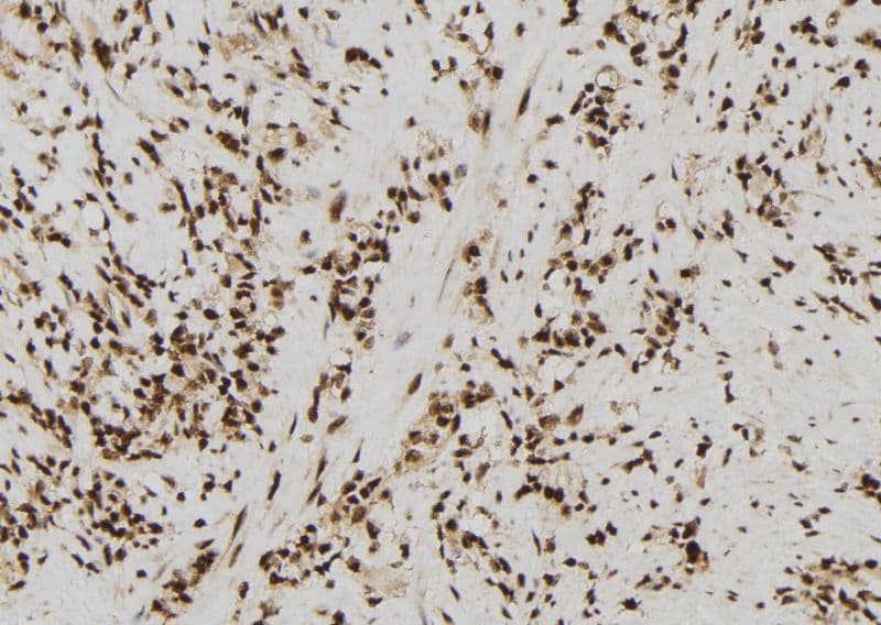 Polyclonal Rabbit anti-Human SIN3B Antibody (IHC, IF, WB)