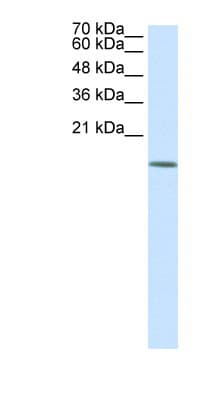 HDAC6 Antibody (aa69-118)