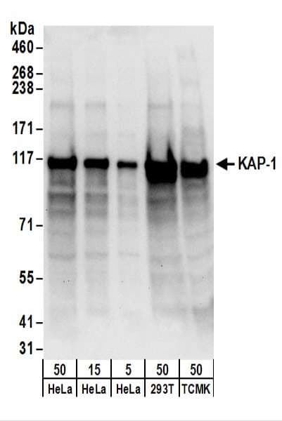 Polyclonal Rabbit anti-Human TRIM28 / KAP1 Antibody (aa650-700, IHC, WB)