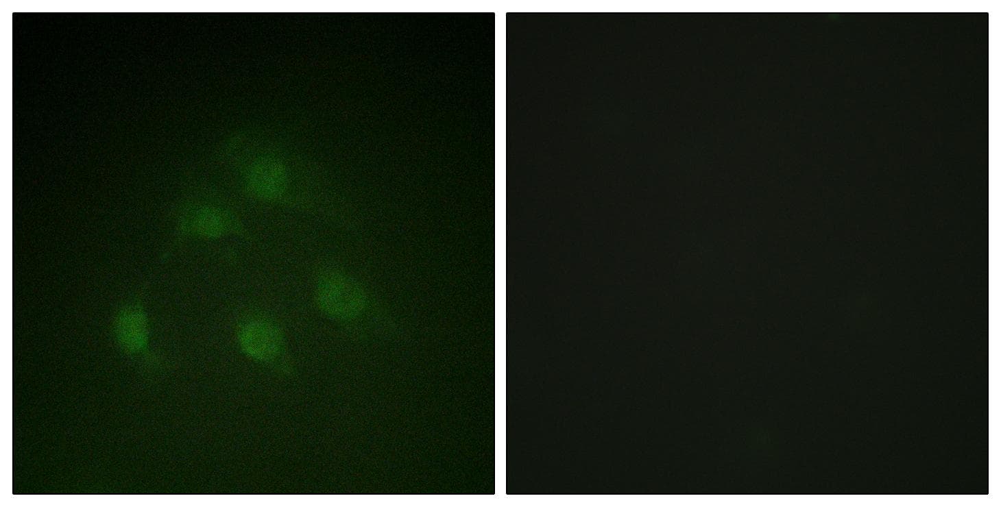 SMAD1 Antibody (p187)