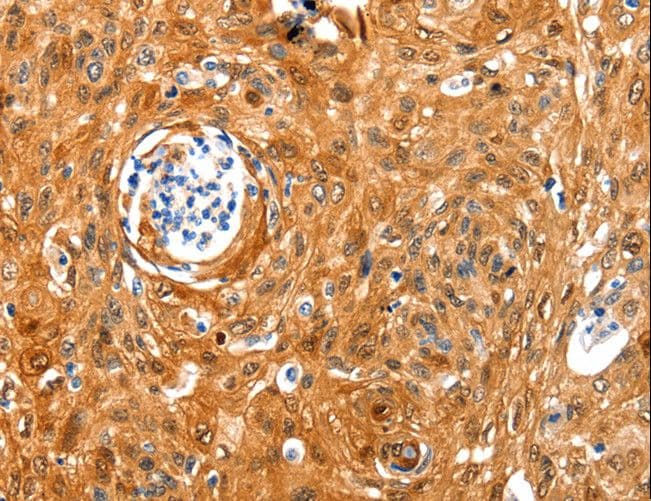 N-CoR / NCOR1 Antibody