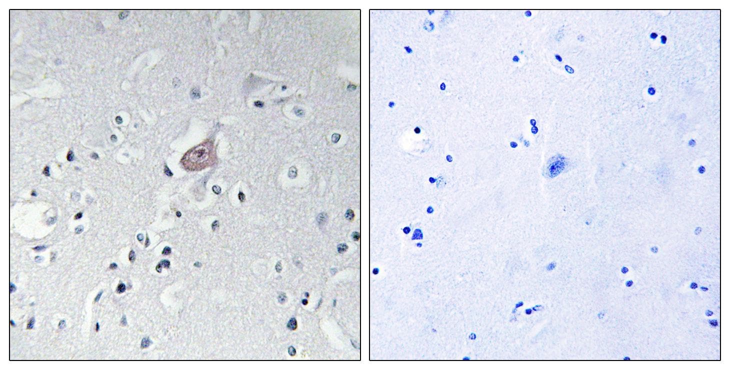 ABL1 / c-ABL Antibody (phospho-Tyr393/412)