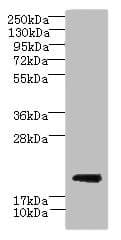Polyclonal Rabbit anti-Human C17orf62 Antibody (IHC, WB)