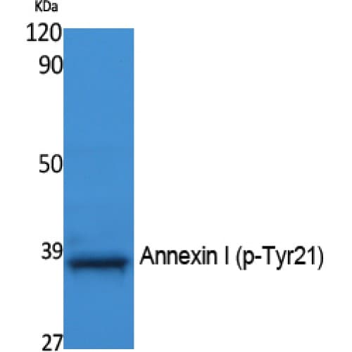 Polyclonal Rabbit anti-Human ANXA1 / Annexin A1 Antibody (10-90 aa, WB)