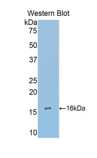 PPARG / PPAR Gamma Antibody (aa149-273, APC)
