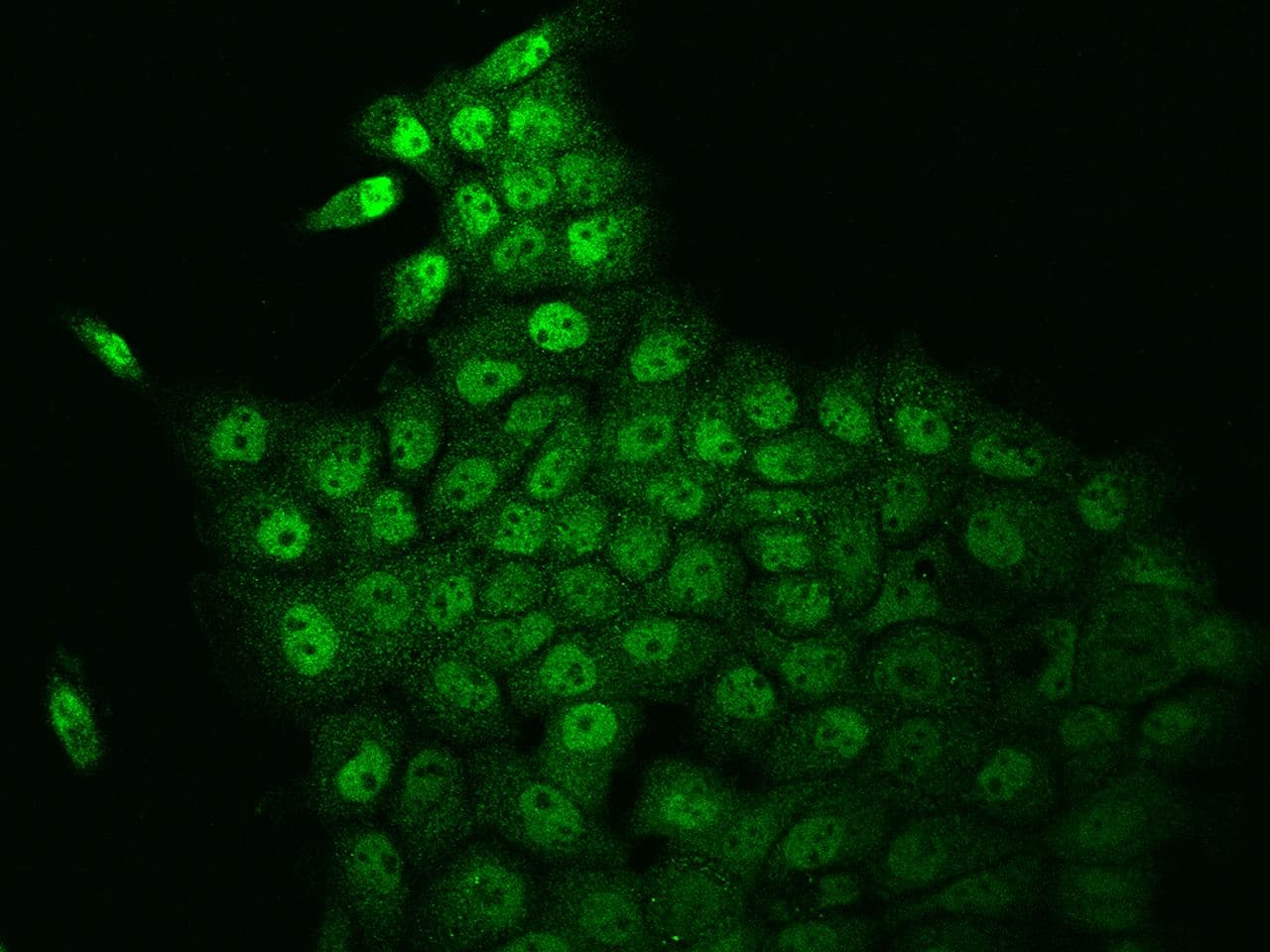 Polyclonal Rabbit anti-Human TAF4B Antibody (IHC, IF)