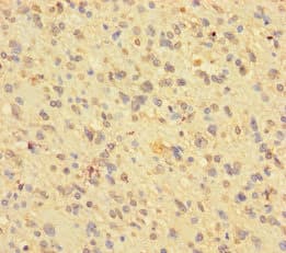 Polyclonal Rabbit anti-Human BMI1 / PCGF4 Antibody (IHC, WB)