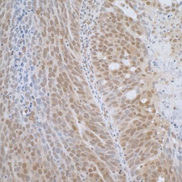 TCEB1 / Elongin C Antibody (aa1-50)