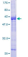 Human KLHDC3 Protein (Recombinant GST)
