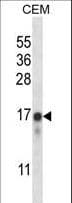 Polyclonal Rabbit anti-Human NCS1 / Neuronal Calcium Sensor Antibody (aa1-30, IHC, WB)