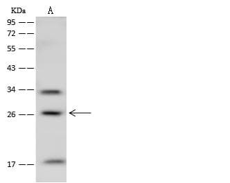 MOBKL2B / MOB3B Antibody (Preservative Free)