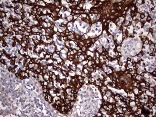 Acidic Cytokeratin Antibody (clone 7F10)