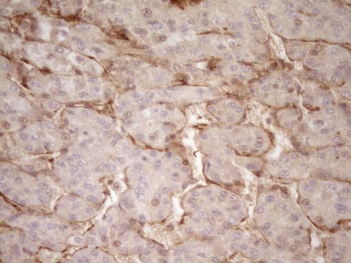 PROCR / EPCR Antibody (aa1-210, clone UMAB201, Carrier-free)