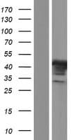 PHKG1 Protein (Over-Expression Lysate Myc-DDK (Flag))