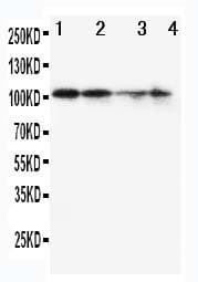 Polyclonal Rabbit anti-Human MCM2 Antibody (aa889-904, IHC, WB)
