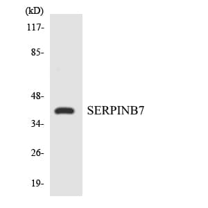 PathPlus™ SERPINB7 / MEGSIN Antibody (aa98-147)