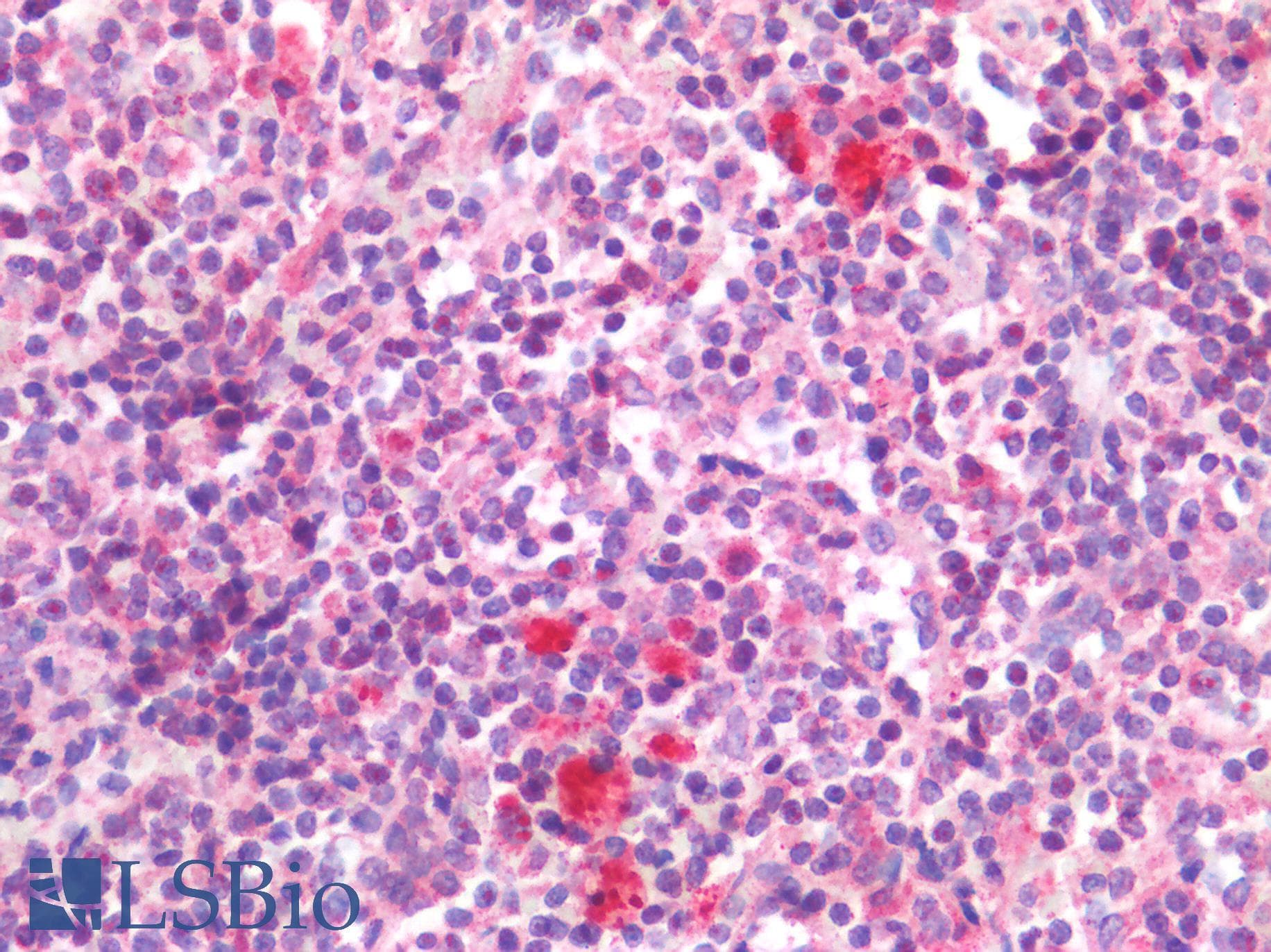 IHC-plus™ IL-33 Antibody