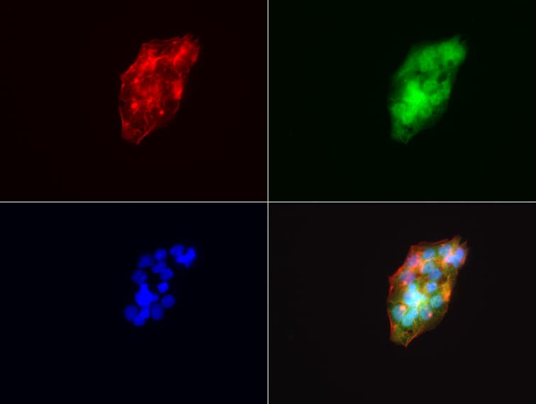 Monoclonal Mouse anti-Human VILIP / VSNL1 Antibody (clone UMAB116, aa2-191, IHC, IF, WB)