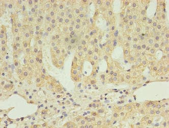 SCARB1 / SR-BI Antibody (aa33-443)