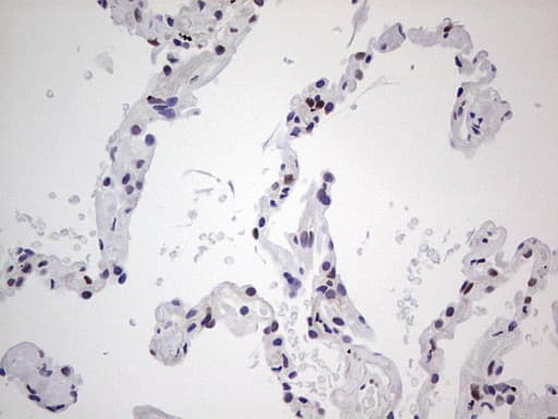 SAE1 Antibody (clone OTI3C3)