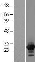 ZFYVE21 Protein (Over-Expression Lysate Myc-DDK (Flag))