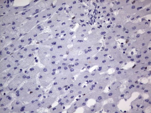 DDX56 Antibody (aa323-547, clone UMAB152)