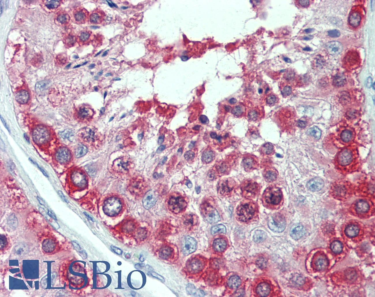 IHC-plus™ TCP1 Antibody (clone 2B2-D6)
