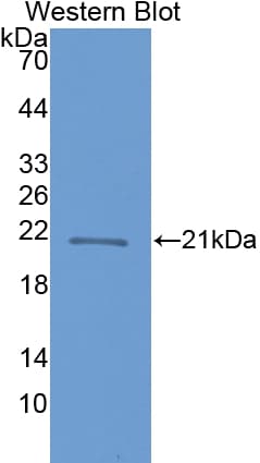 CRYBB1 Antibody (aa17-191)