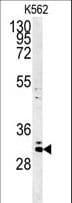 Polyclonal Rabbit anti-Human C2orf49 Antibody (aa62-90, IHC, WB)